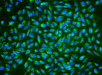 Anti-ALDH2 Antibody (monoclonal, 6H2)