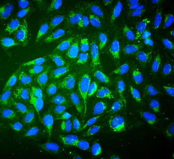Anti-ALDH2 Antibody (monoclonal, 6H2)