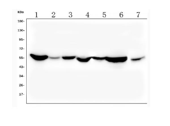 Anti-ALDH2 Antibody (monoclonal, 6H2)