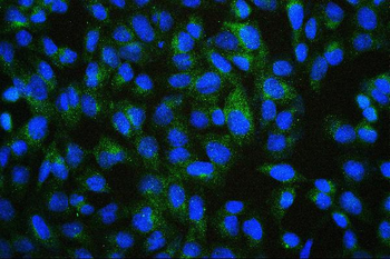 Anti-ALIX/PDCD6IP Antibody (monoclonal, 14D10)