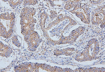 Anti-ALIX/PDCD6IP Antibody (monoclonal, 14D10)