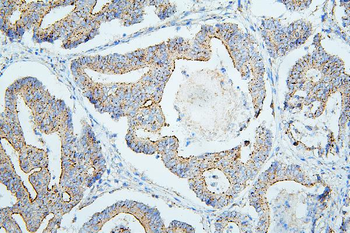 Anti-ALIX/PDCD6IP Antibody (monoclonal, 14D10)