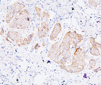 Anti-ALIX/PDCD6IP Antibody (monoclonal, 14D10)