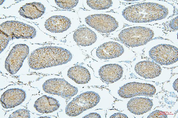 Anti-ALIX/PDCD6IP Antibody (monoclonal, 14D10)