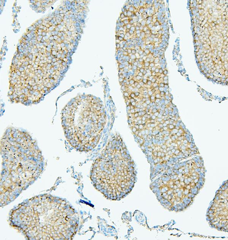 Anti-ALIX/PDCD6IP Antibody (monoclonal, 14D10)