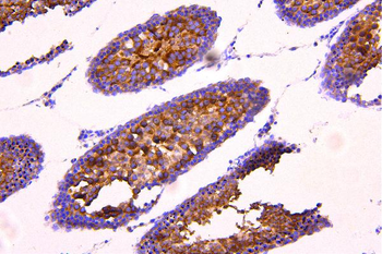 Anti-Acetyl Coenzyme A Carboxylase/ACACB Antibody