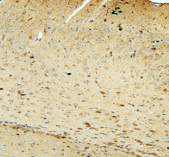 FACL4/ACSL4 Antibody