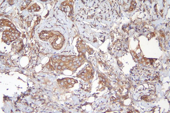 Anti-APPL/APPL1 Antibody
