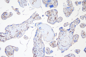 Anti-APPL/APPL1 Antibody
