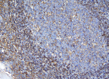 Anti-APPL/APPL1 Antibody
