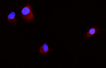 Anti-beta 2 Microglobulin/B2m Antibody