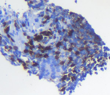Anti-CD5 Antibody
