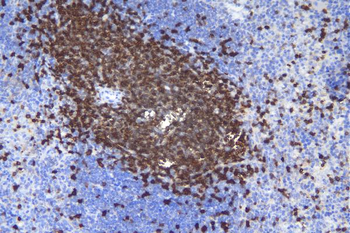 Anti-CD5 Antibody
