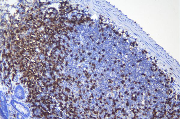 Anti-CD5 Antibody