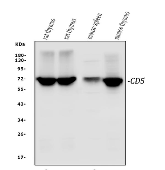 Anti-CD5 Antibody