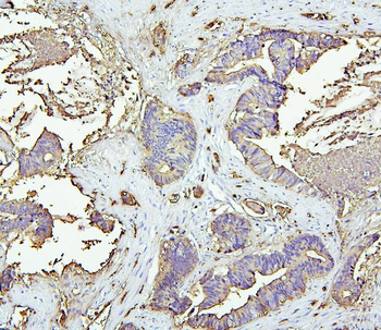 Anti-CEACAM5 Antibody
