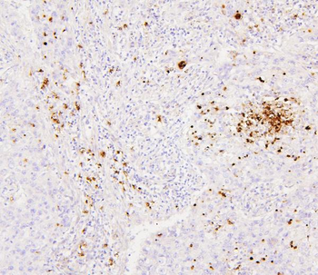 Anti-CEACAM5 Antibody