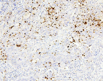 Anti-CEACAM5 Antibody