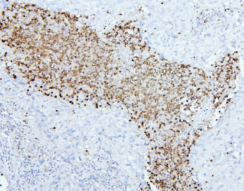 Anti-CEACAM5 Antibody