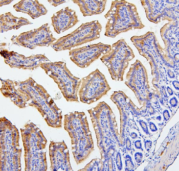 Anti-CEACAM5 Antibody