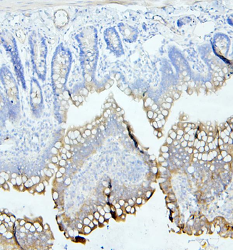 Anti-CEACAM5 Antibody