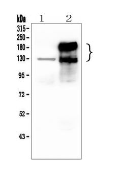 Anti-CEACAM5 Antibody