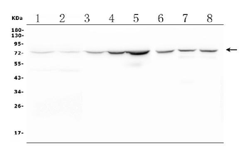 Anti-CPT2/CPT1 Antibody