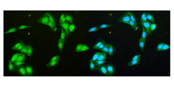 Anti-DDX1 Antibody