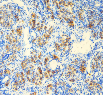 Anti-DDX1 Antibody
