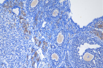 Anti-DDX1 Antibody