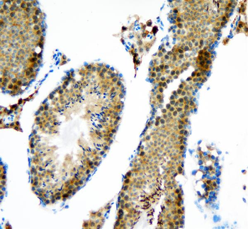 Anti-DDX1 Antibody
