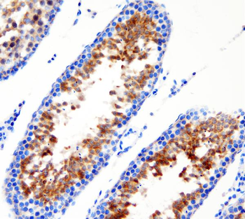 Anti-DDX1 Antibody