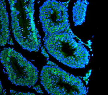 Anti-DDX4/MVH Antibody