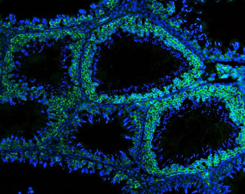 Anti-DDX4/MVH Antibody