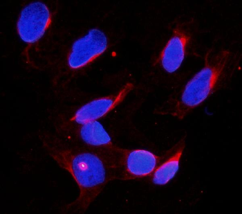 Anti-DDX4/MVH Antibody