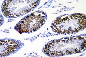 Anti-DDX4/MVH Antibody