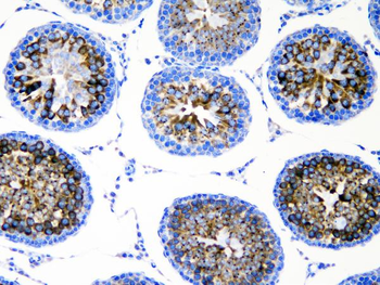 Anti-DDX4/MVH Antibody