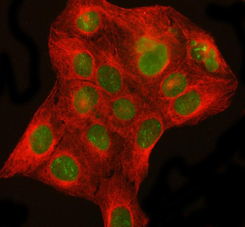 DHX15/prp43 Antibody