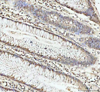 DHX15/prp43 Antibody