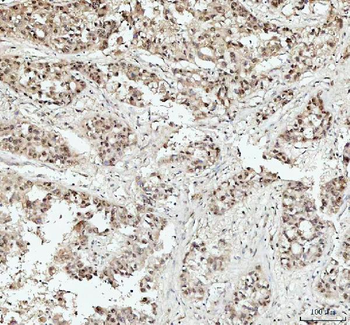 DHX15/prp43 Antibody