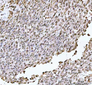 DHX15/prp43 Antibody