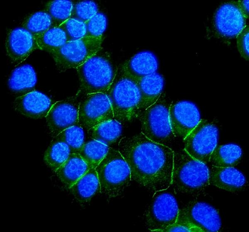 Anti-Desmoglein 2/DSG2 Antibody