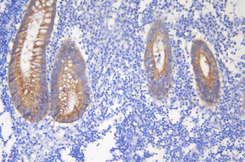 Anti-Desmoglein 2/DSG2 Antibody