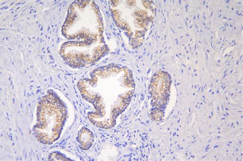 Anti-Desmoglein 2/DSG2 Antibody
