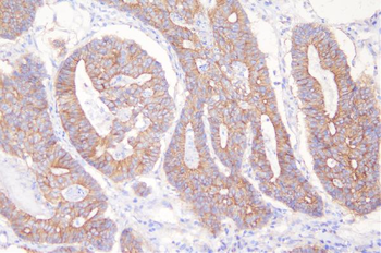 Anti-Desmoglein 2/DSG2 Antibody