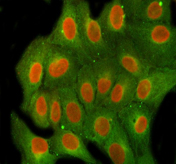 Anti-FEN1 Antibody