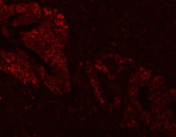 Anti-FEN1 Antibody