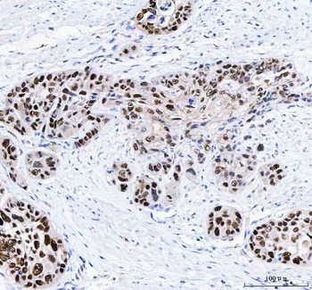 Anti-FEN1 Antibody