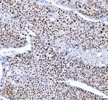 Anti-FEN1 Antibody