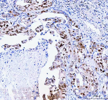 Anti-FEN1 Antibody